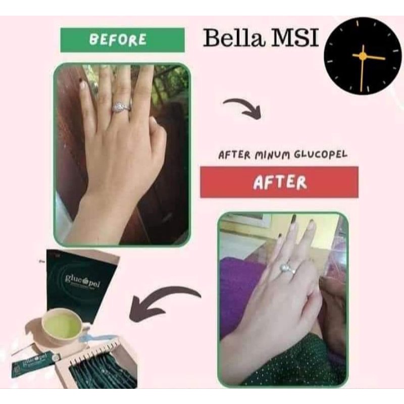 3 PAKET USAHA MINUMAN COLAGEN PUTIH PERMANEN TANPA SUNTIK