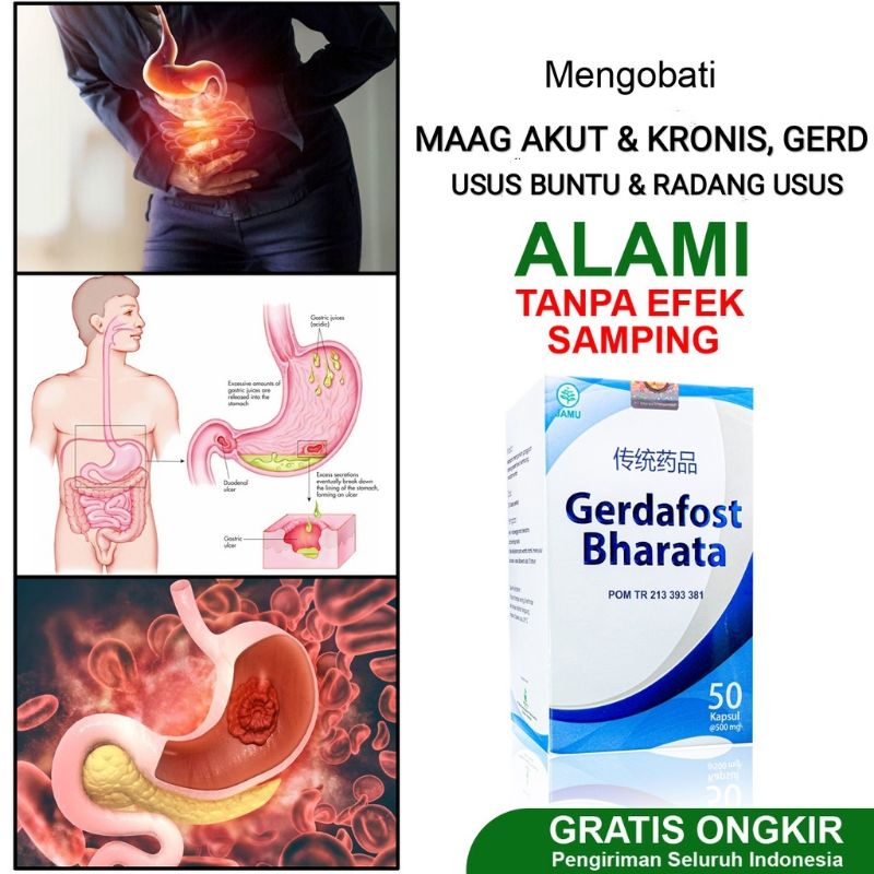 Jual Obat Maag Akut & Kronis, Obat Gerd, Obat Usus Buntu, Obat Radang