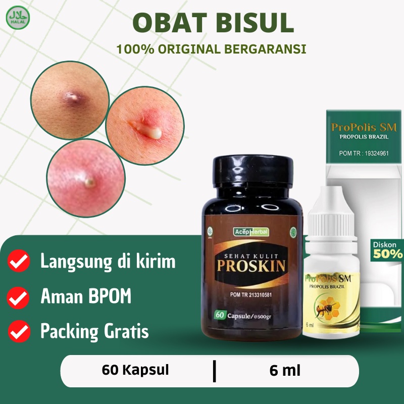 Proskin - Obat Bisul, Obat Bisul di pantat, Obat Bisul pada kelamin, Obat Bisulan , Salep bisul, Oba