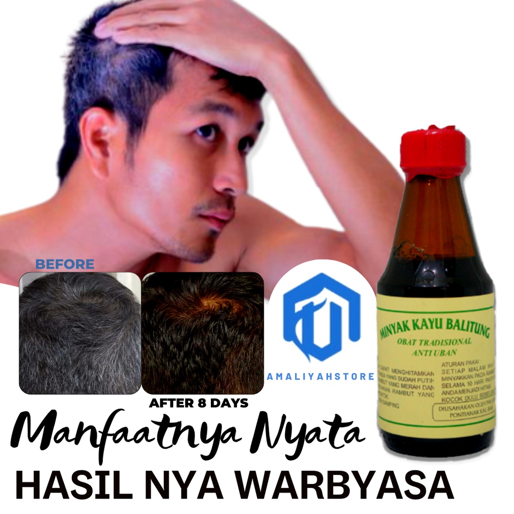 Minyak Kayu Balitung Asli 100% Dari Kalimantan Obat Vitamin Penumbuh Penyubur Pelebat Penebal Penghitam Pelurus Rambut Anti Botak Dan Rontok Anak Pria Dan Wanita Penghilang Uban Cepat Hitam Permanen Di Usia Muda