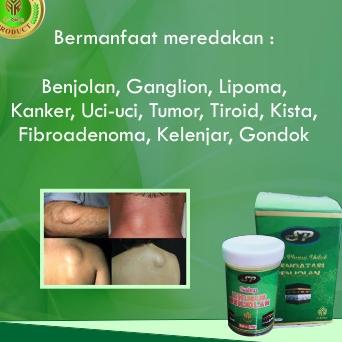 ば ( TERLARIS ) SALEP KHUSUS BENJOLAN AR-RAIHAN - MENGOBATI BENJOLAN - GONDOK - TUMOR _ obat kista. benjolan kista. Qahira. minyak Qahira, qahira obat benjolan .obat qahira.qahira oiriginal ↩