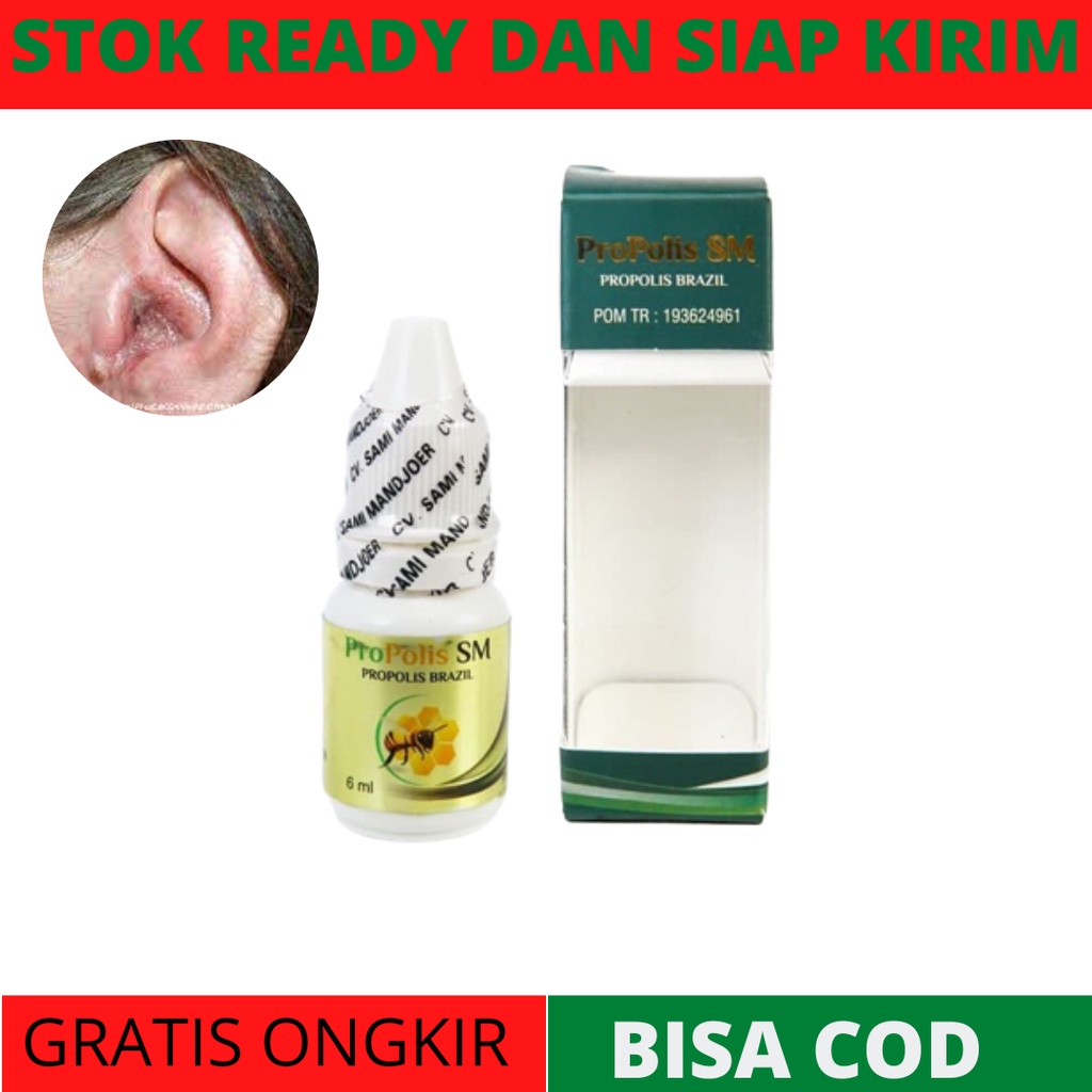 Obat Telinga Berair, Obat Telinga Budeg, Obat Telinga Bernanah Dan Bau, obat Congek, obat Telinga Ce
