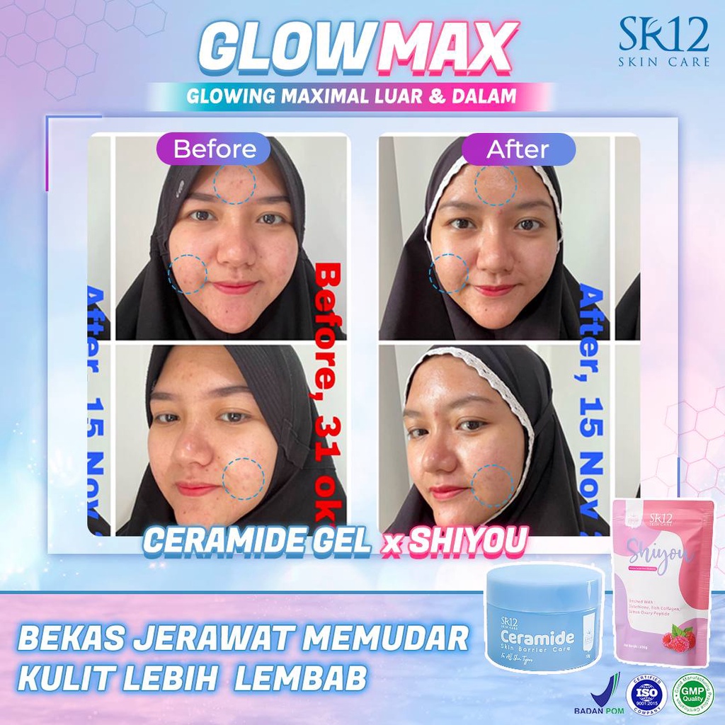 Shiyou SR12 Minuman Collagen Pemutih Badan BPOM Mencegah Kulit Keriput Menyehatkan Saluran Pencernaan