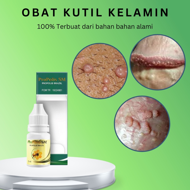 Obat kutil kelamin pria , Obat kutil kelamin pria, Kutil kelamin, Obat Kutil Kelamin HPV Obat kutil 