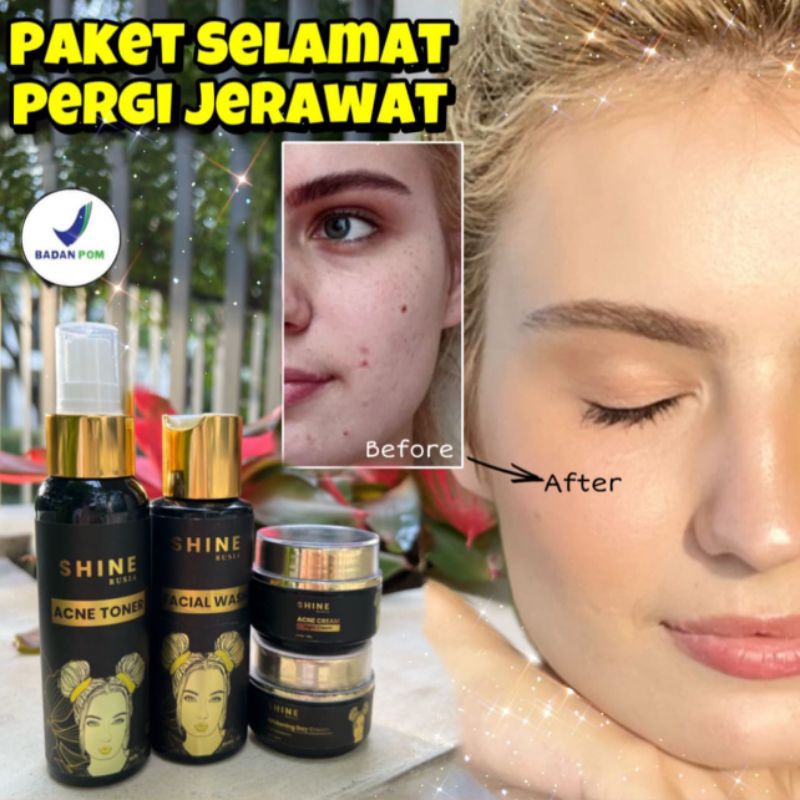 Paket Acne Shine Rusia Skincare BPOM