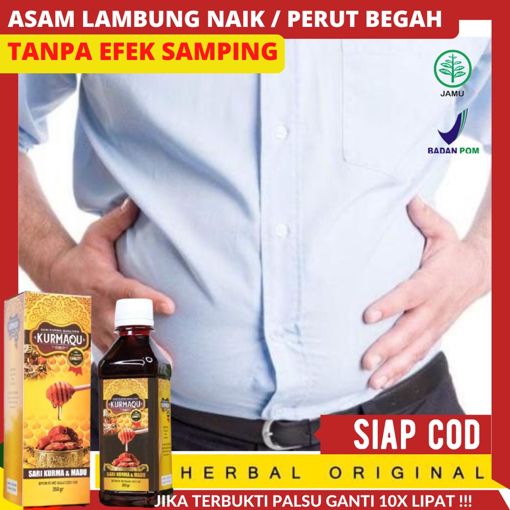 Cara Mengatasi perut Kembung dan Begah dengan cepat - Herbal Alami Solusi Perut Kembung  Begah sesak