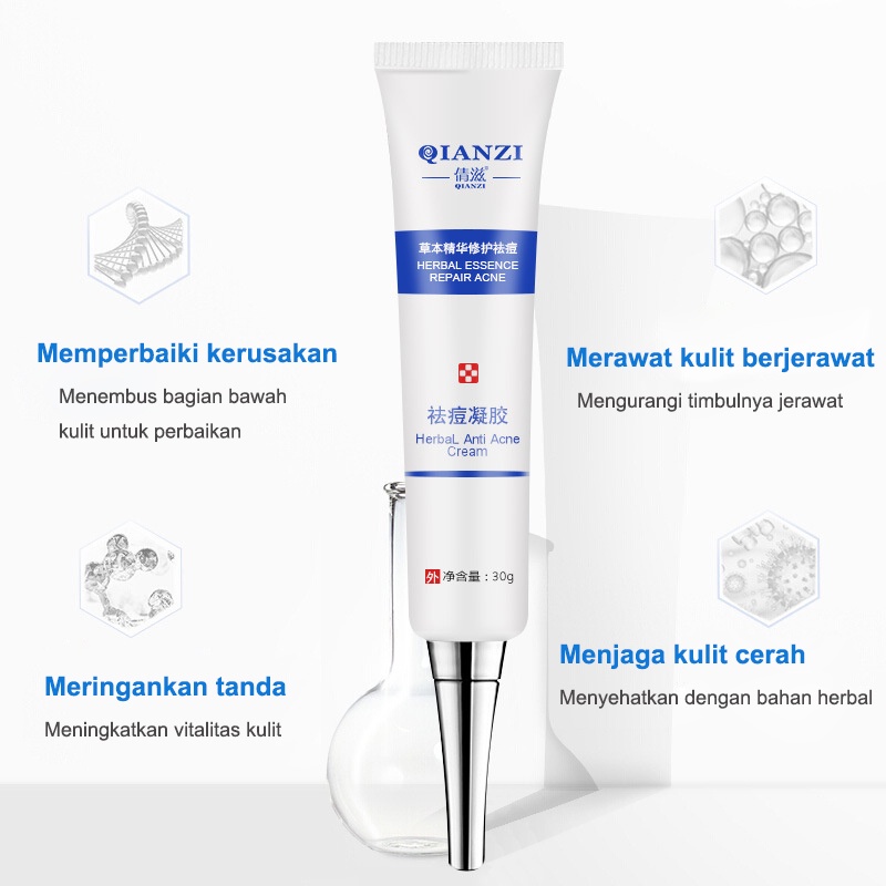 cream jerawat krim jerawat Acne treatment Cream  jerawat Obat jerawat Penghilang bekas 30g jerawat Memudarkan jerawat Serum acne Krim jerawat Krim penghilang jerawat