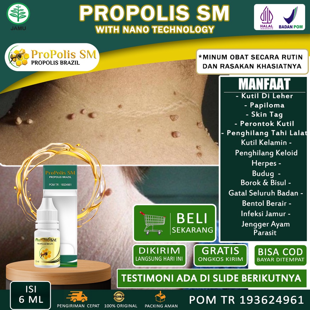 Obat Papiloma Perontok Kutil Di Leher Penghilang Skin Tag Dan Tahi Lalat Perontok kutil Bruntusan Di
