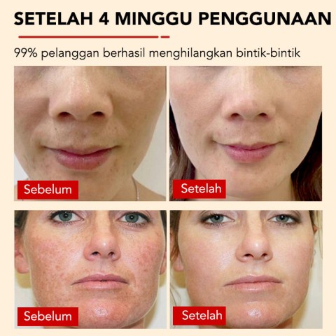 Arbutin Brightening Essence Natural Whitening Menghilangkan Bintik Hitam Meningkatkan Elastisitas Kulit Mengurangi Jerawat