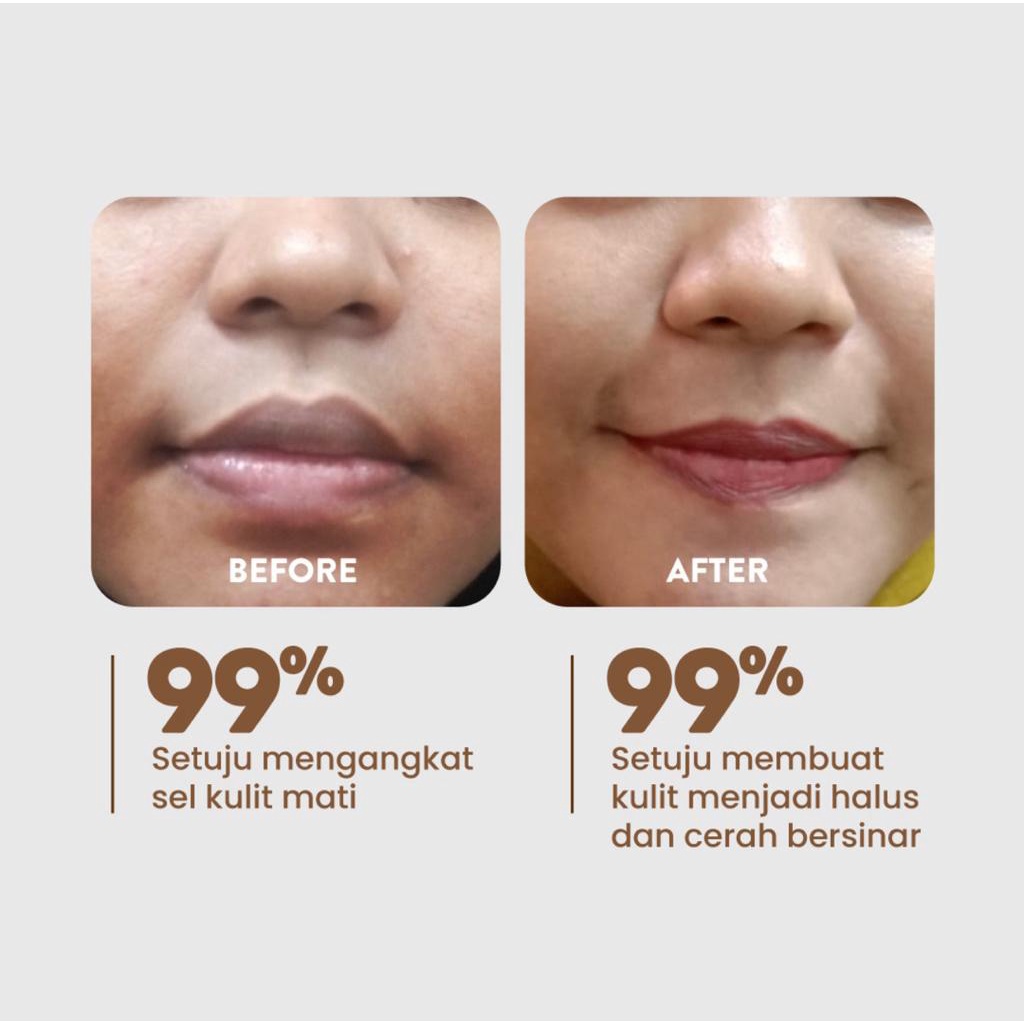 NPURE LICORICE LIGHT UP BRIGHTENING PAD