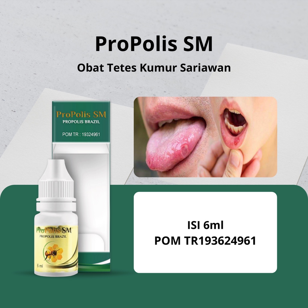 Jual Obat Tetes Kumur Sariawan, Obat Sariawan di Mulut, Obat Sariawan
