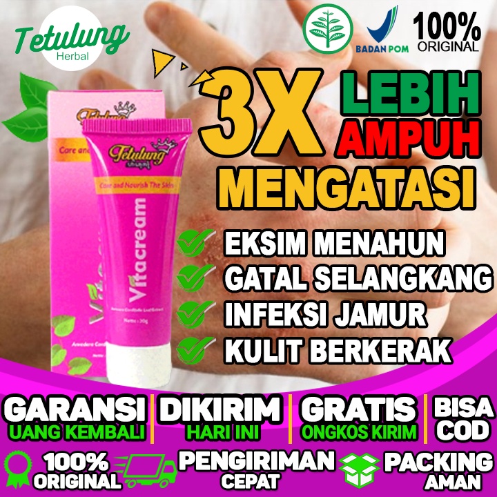 Salep Untuk Gatal Yang Bernanah Salep Untuk Bekas Gatal Yang Menghitam Dan Selangkangan Gatal