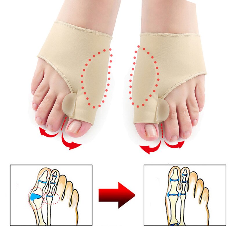 1 Pasang Corrector Bunion Hallux Orthotic Insole / Gel Kain Lembut Pelindung Alat Korektor Jempol Jari Kaki Pelurus