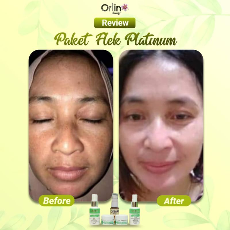 Paket flek+serum flek/krim penghilang flek tebal/krim bpom