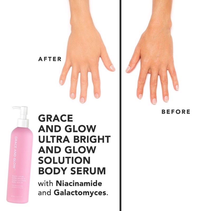 BPOM - Grace and Glow Black Opium Ultra Bright &amp; Glow Solution + English Pear and Freesia Anti Acne &amp; Scar Body Serum