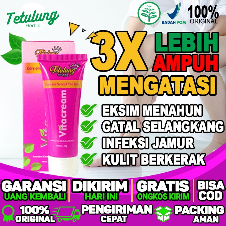 Salep Gatal Telapak Tangan Salep Daun Telinga Gatal Dan Berair Salep Gatal Untuk di area kaki