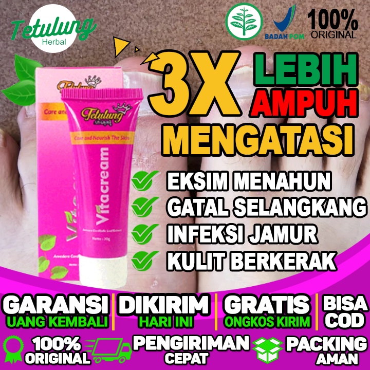 Salep Untuk Gatal Merah Di Selangkangan Salep Untuk Gatal Menahun Salep Untuk Gatal Merah Berair