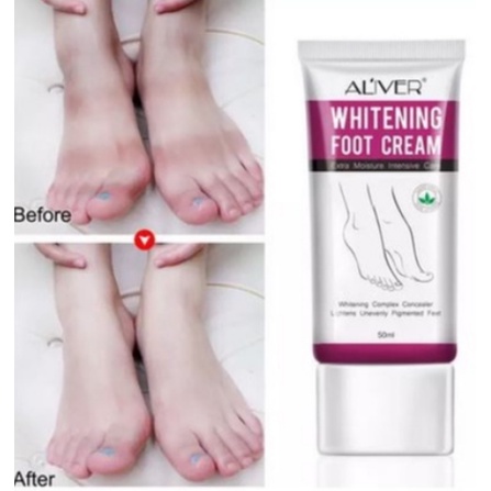 Krim Pelembab Kaki / Krim Penghilang Belang Kaki / Perawatan Pemutih Kaki