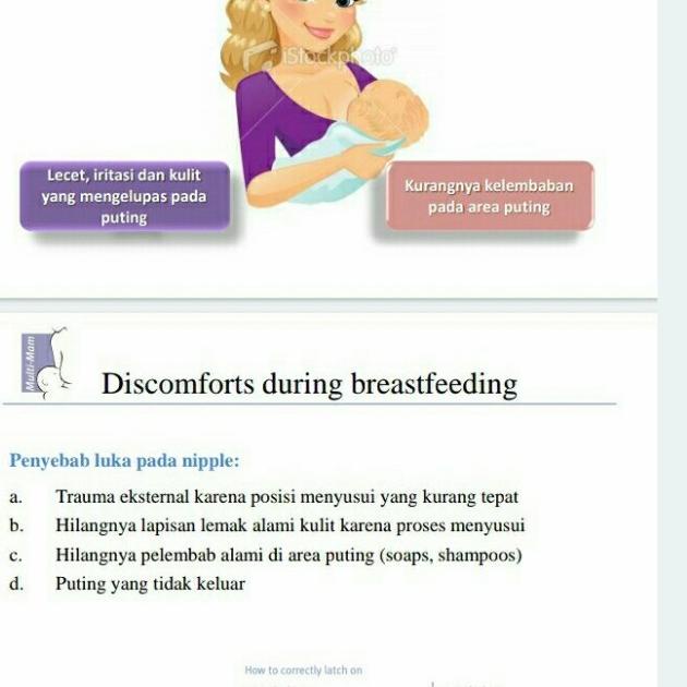 Multi Mam Compresses Per Box / Kompres Puting Payudara Breast