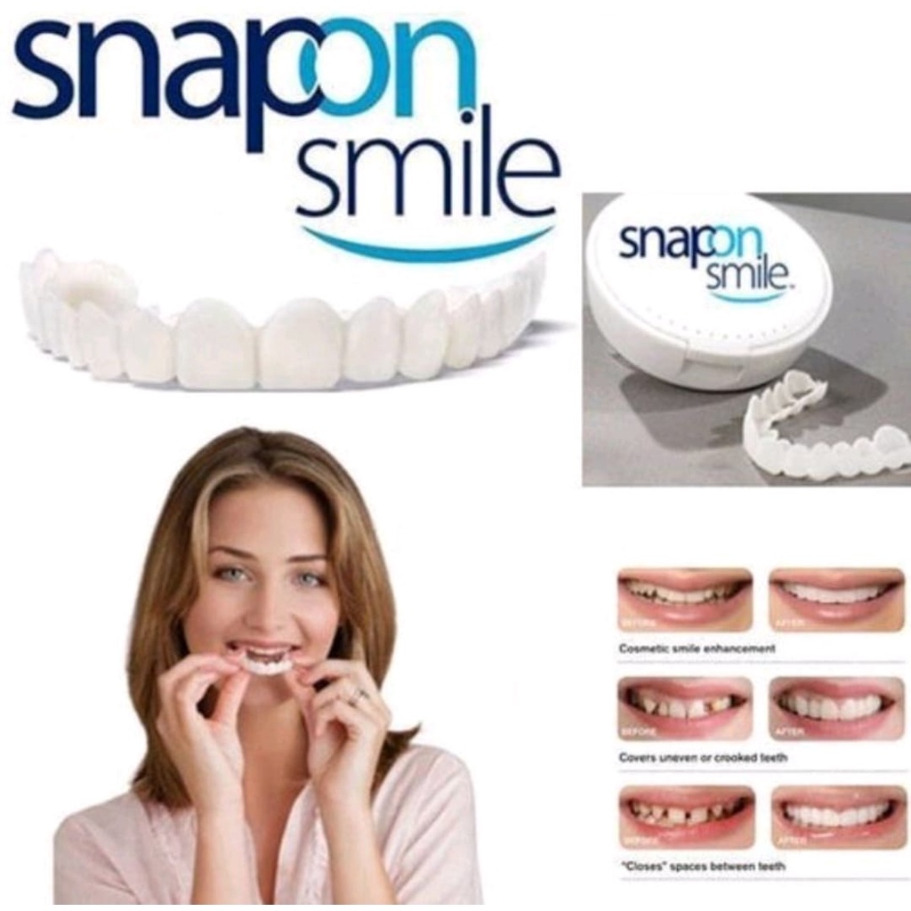 SNAP ON SMILE 100% ORIGINAL AUTHENTIC VENEER GIGI PALSU 1 SET ATAS BAWAH