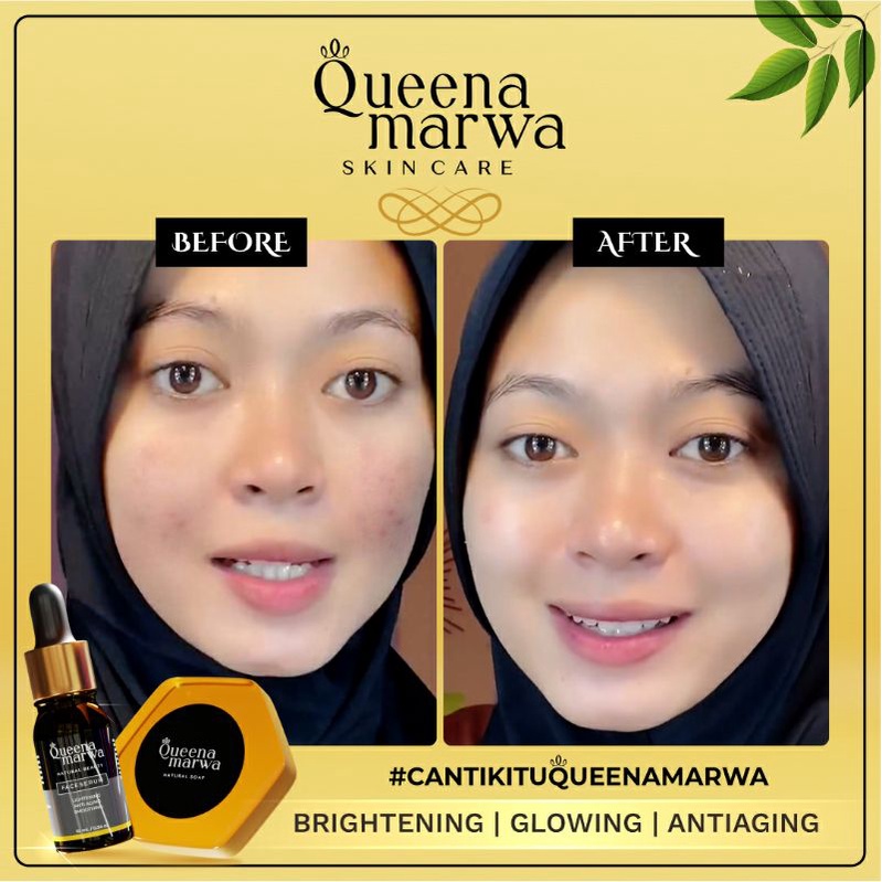 Queena Marwa Natural Soap Original Sabun Wajah Aman BPOM 80 gr