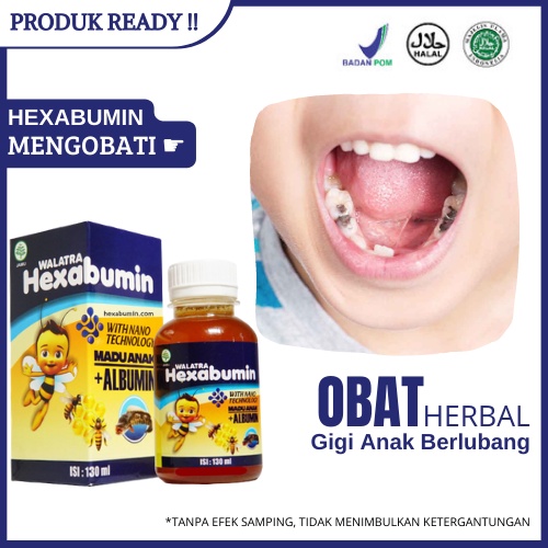 Obat Gigi Anak Berlubang - Sakit Gigi Anak 3 4 5 6 Tahun - Gusi Anak Bengkak Merah | Walatra Hexabum