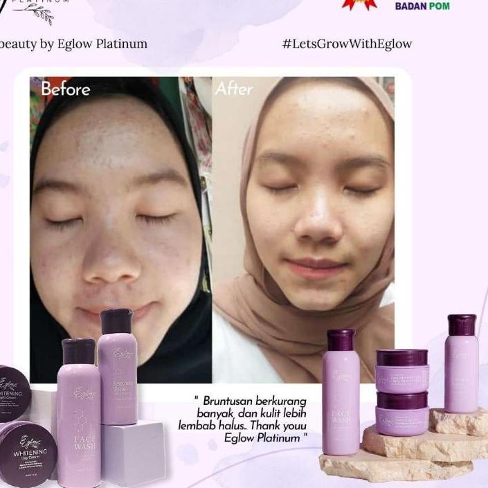 ₳ eglow platinum bpom ecer skincare eglow kemasan baru ↚