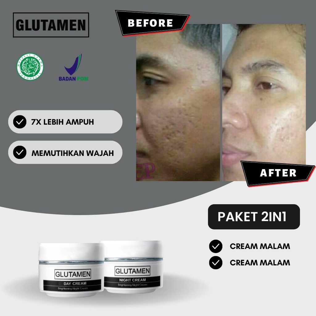 Glutamen Skincare BPOM Cream Siang Krim Malam Brightening Pemutih Wajah Penghilang Jerawat Pria