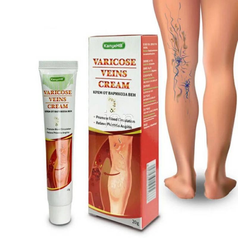 Krim Varises, Varicose Veins Cream Varikokel