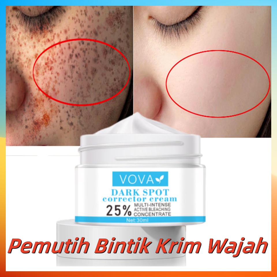 Jual Vova Cream Penghilang Flek Hitam G Cream Flek Asli Memudarkan Bintik Pemutih Kulit