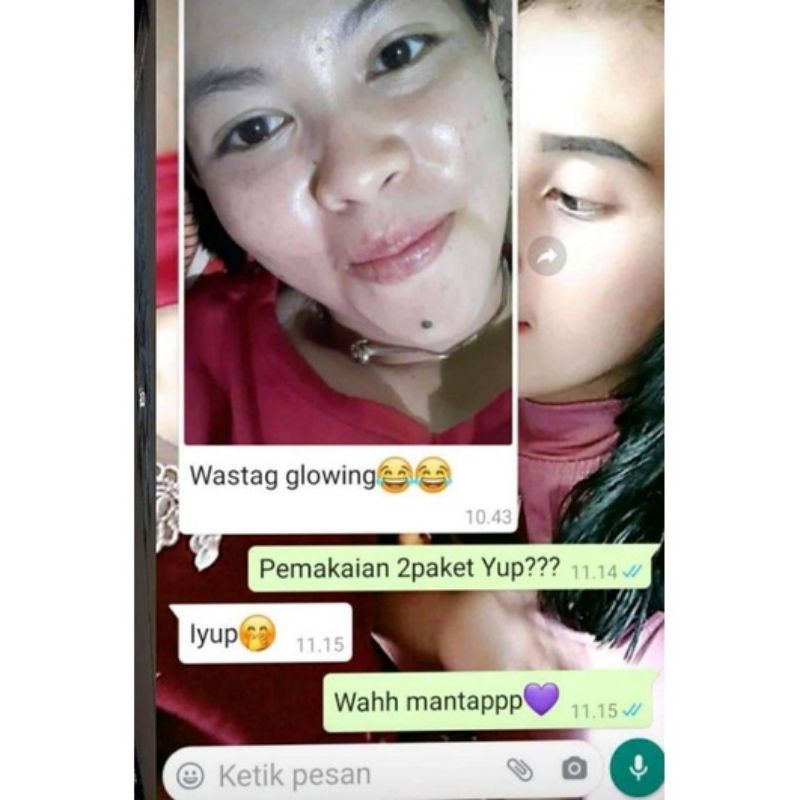 NEW NBS SKINCARE EXTRA GLOW PLUS SERUM MENGGLOWINGKAN 2X LEBIH CEPAT