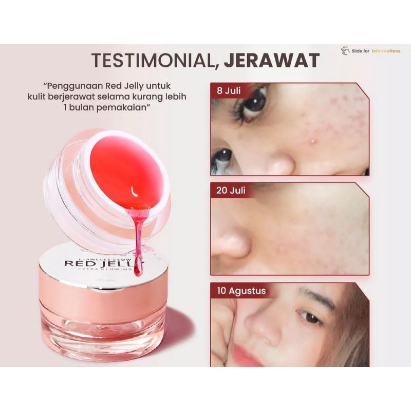 RED JELLY ORIGINAL PRODUK DARI MS GLOW (promo akhir tahun)