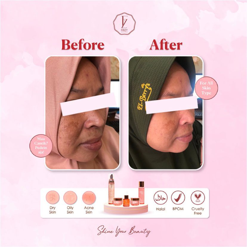 Paket Frizy Brightening Series Skincare Pencerah glowing BPOM HALAL