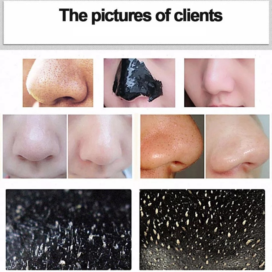 HS MASKER WAJAH KOMEDO VEZE PEEL OFF MASK CHARCOAL REMOVE BLACKHEAD