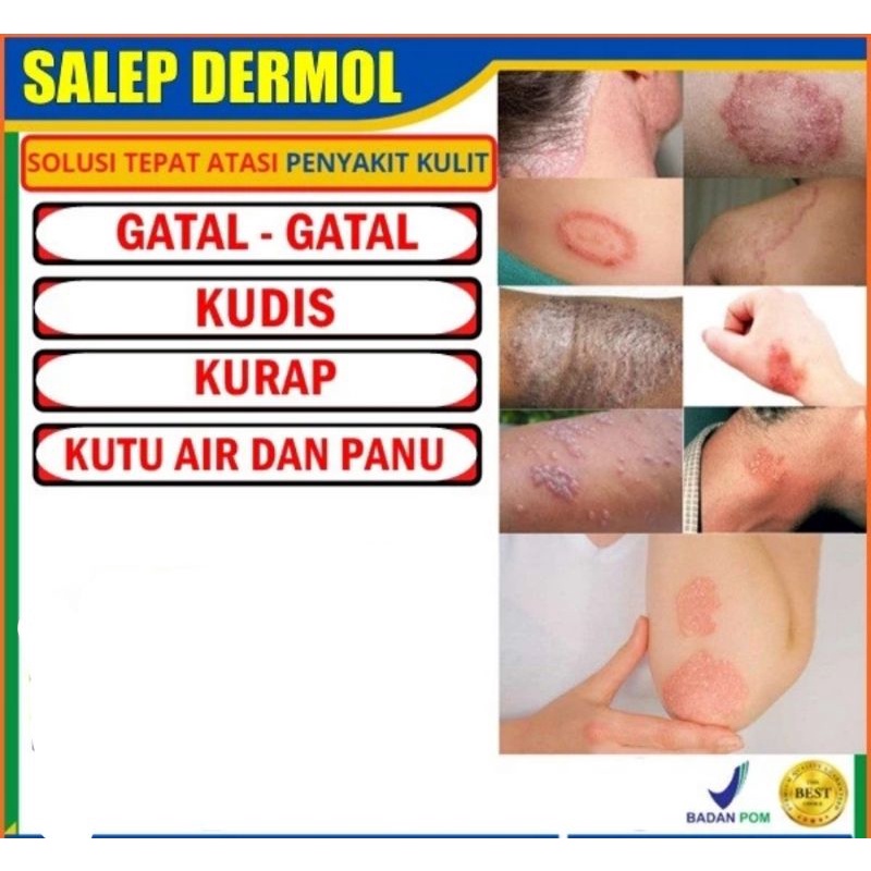 DERMOL SALEP GATAL KURAP KUDIS PANU JAMUR KUTU AIR