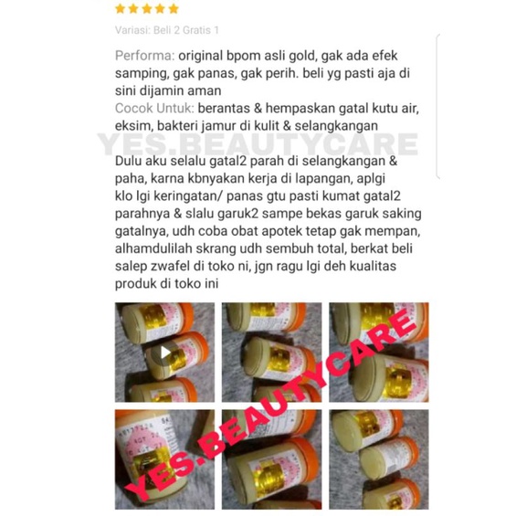 SALEP ZWAFEL 24 ORIGINAL BPOM ASLI CITO 2-4 100% OBAT SALEB GATAL PANU KADAS KURAP KUTU AIR JAMUR EKSIM SCABIES SELANGKANGAN AMPUH