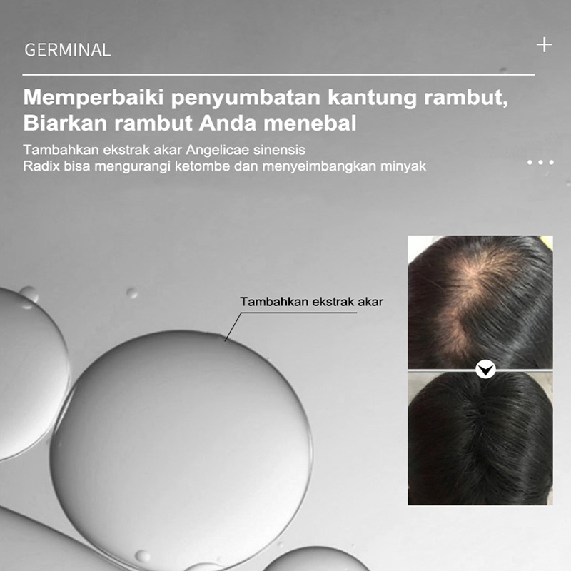 [2022 Terbaru] penumbuh rambut / penumbuh rambut botak / serum rambut rontok / 100%Asli Esensi Pertumbuhan Rambut Rollerball - Memijat pori-pori Mempercepat penyerapan Mempercepat pertumbuhan rambut 20ml