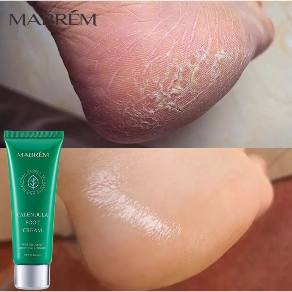 ORI 100% MABREM KREM TANGAN KAKI KERING PECAH-PECAH TUMIT KASAR/CREAM PERBAIKAN KULIT KAKI KASAR MEN
