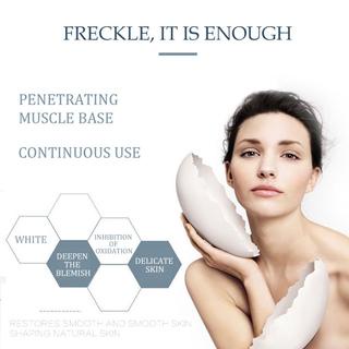 【COD】Whitening Freckle Cream acne cream Remove Dark Spots Anti Freckle Cream  Fade Pigmentation Melasma Brighten Creams Penghapusan Jerawat