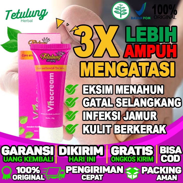 Salep Untuk Gatal Daerah Kemaluan Salep Untuk Gatal Di Tangan Salep Untuk Gatal Di Ketiak