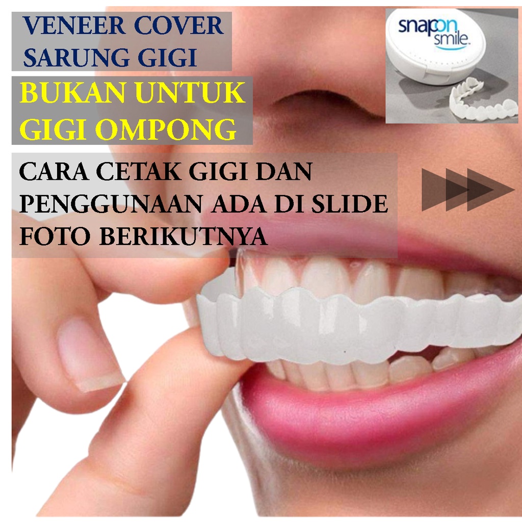 Merapikan Gigi Tonggos Dengan Veneer – EVOULZ