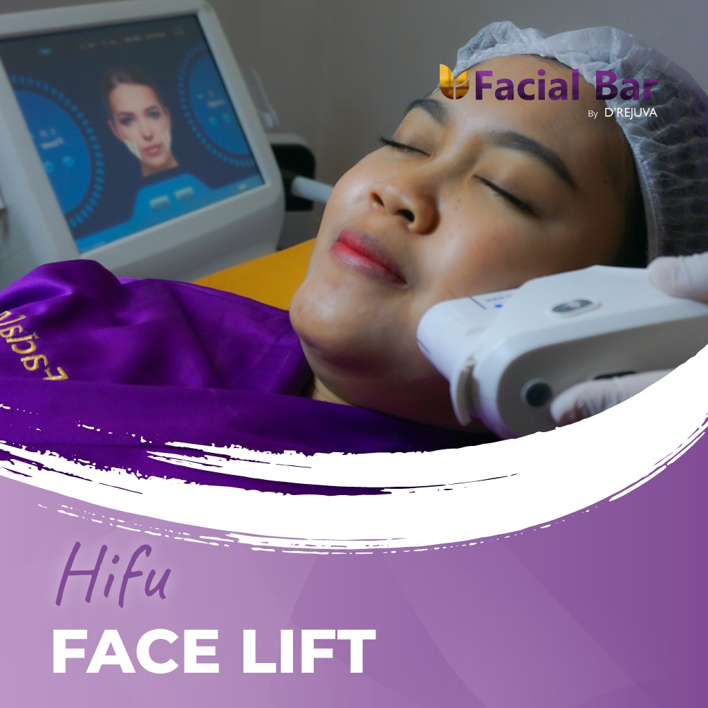 Hifu Face Lift