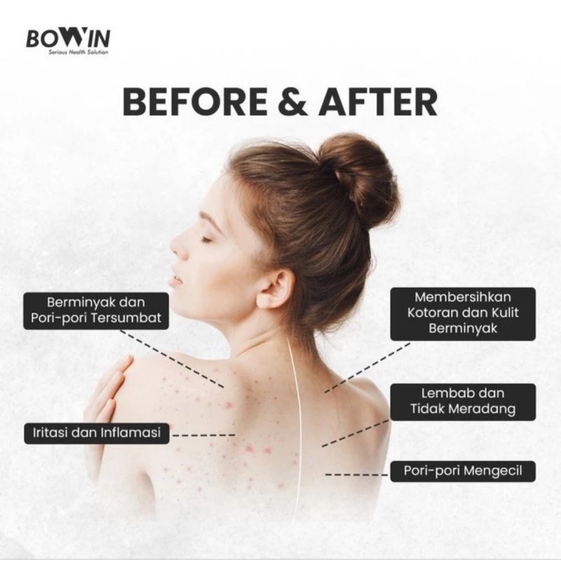 Bowin Back &amp; Chest Acne Spray (Maskne Centella Asiatica&amp;Allantion) 75ml