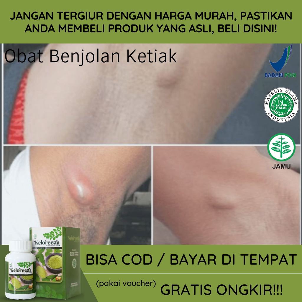 Jual Keloreena Ekstrak Daun Kelor Untuk Mengobati Benjolan Di Ketiak Obat Herbal Benjolan 7522