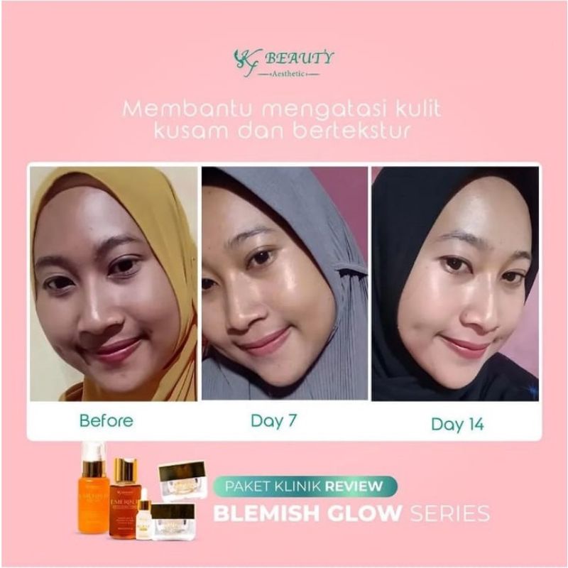 KF SKIN KLINIK BEAUTY TAHAP 1 BLEMISH GLOW KEMASAN BARU