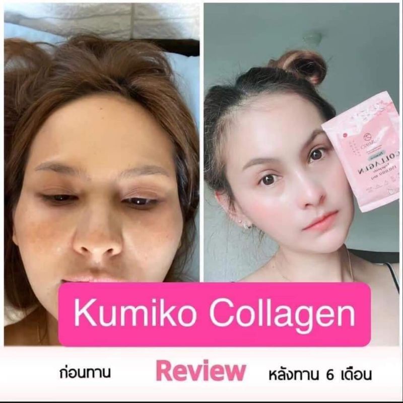 KUMIKO COLLAGEN TRIPEPTIDE 150.000mg Drink Kolagen Pemutih kulit 1Box 15 sachet