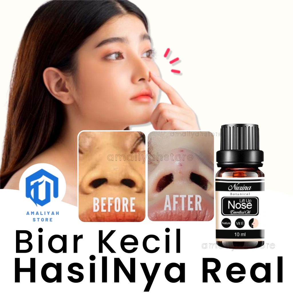 Alat Obat Minyak Pemancung Memancungkan Hidung Permanen Mancung Alami Pria Dan Wanita Ampuh Nose Up Lift Essential Oil Serum 10 Ml Penjepit Pengecil Hidung Besar Kecil 100% Original