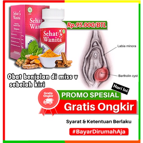 Obat benjolan di miss v sebelah kiri | Penghilanga kista kelenjar bartholin, kista vagina, herpes pa
