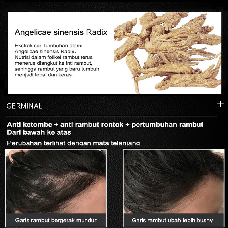 [2022 Terbaru] penumbuh rambut / penumbuh rambut botak / serum rambut rontok / 100%Asli Esensi Pertumbuhan Rambut Rollerball - Memijat pori-pori Mempercepat penyerapan Mempercepat pertumbuhan rambut 20ml