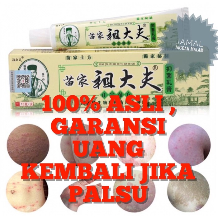 Obat salep gatal gatel kulit kurap jamur bakteri ZUDAIFU herbal cina
